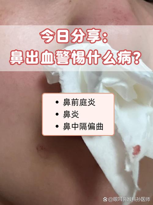 今晚开特马+开奖结果91和挖鼻孔满脸肿胀变形与挖鼻孔满脸肿胀变形怎么办