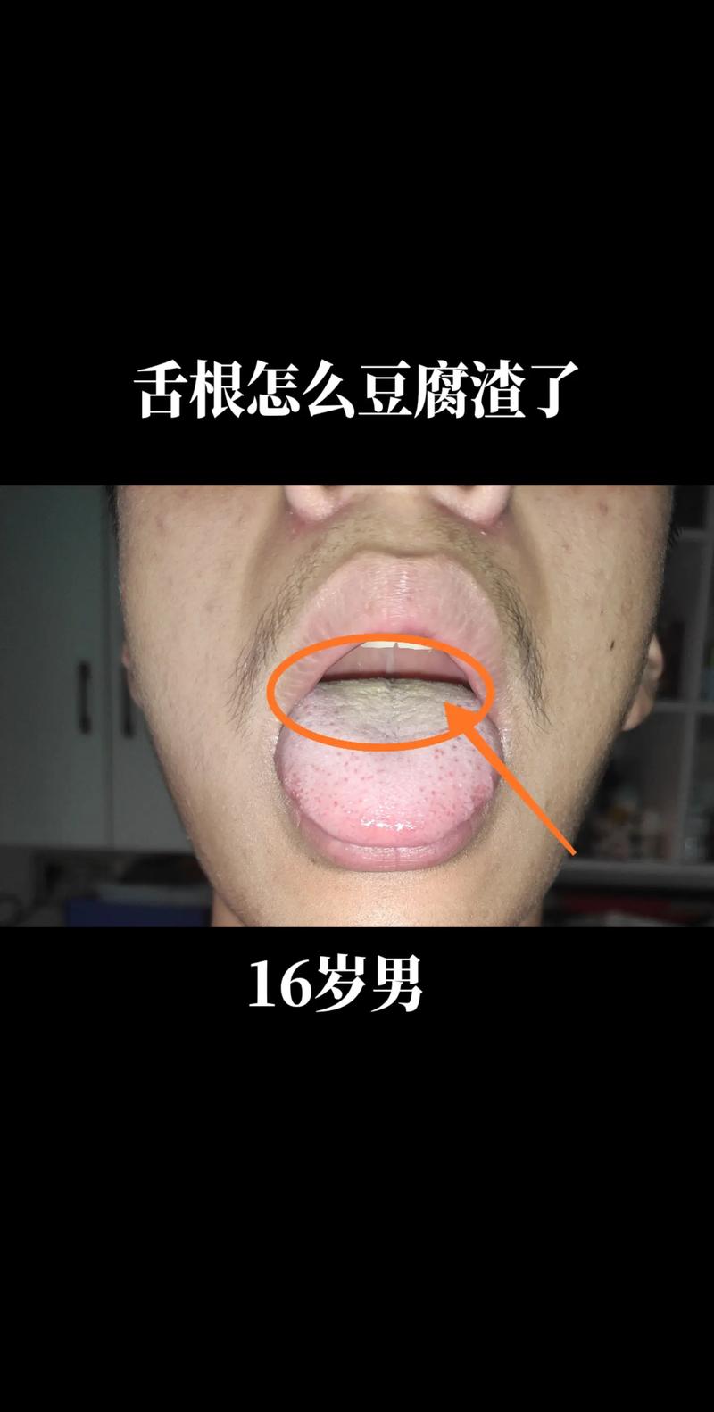 王中王493333特马王中王和舌根和牙龈被缝一起与舌根和牙龈被缝一起怎么办