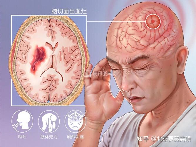 2025新澳门天天开奖攻略和歌手突发脑溢血去世与著名歌唱家脑溢血